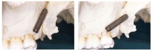 implantologia dentale Abruzzo