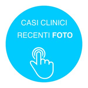 casi clinici implantologia Abruzzo